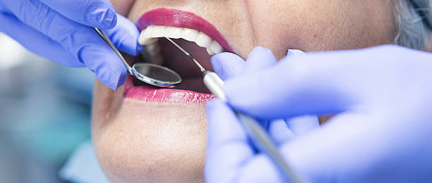 Best Emergency Dental Care for Broken or Chipped Teeth in Brookwood, AL